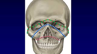 Facial Fractures 1 [upl. by Xever]