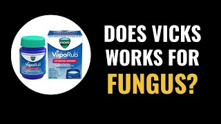 Does Vicks Vaporub work for fungus nails [upl. by Ecinnej]