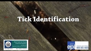 Tick Identification [upl. by Noevart385]