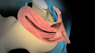 Dilation and Curettage D amp C [upl. by Aratas]