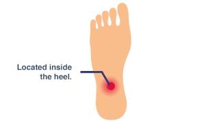 SHOCKING Therapy for heel amp foot pain [upl. by Brucie343]