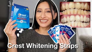 I TRIED THE CREST 3D WHITESTRIPS FOR 14 DAYS Effective  Before amp After pictures [upl. by Staal691]