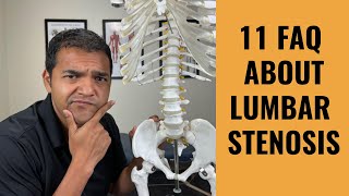 11 Most Frequently Asked Questions About Lumbar Spinal Stenosis [upl. by Eeram]