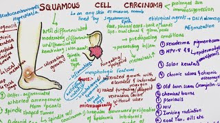 Squamous Cell Carcinoma  Pathology [upl. by Timmy]