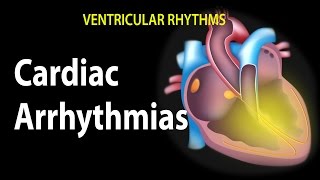 Cardiac Arrhythmias Animation [upl. by Nilrev]