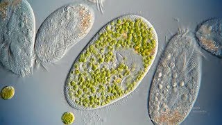 What are Ciliates [upl. by Pernell]