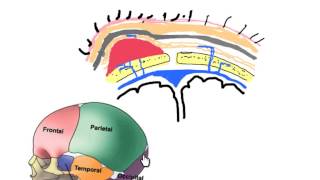 scalp hematomas in neonates [upl. by Eseerehs]