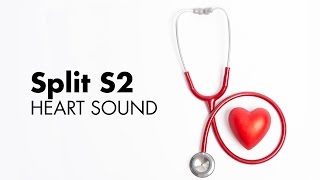 Fixed Split S2  Heart Sounds  MEDZCOOL [upl. by Gun405]