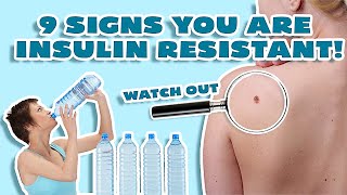 Insulin Resistance Symptoms WHY YOU CANT LOSE WEIGHT [upl. by Esbensen394]