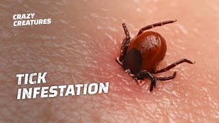 WARNING The Most Horrific Tick Infestations [upl. by Georgeta226]