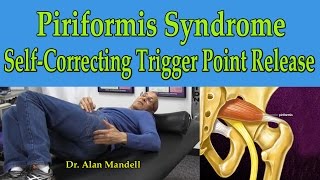 Piriformis Syndrome SelfCorrecting Trigger Point Release  Dr Mandell [upl. by Giacinta311]