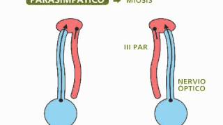 Reflejos pupilares  Oftalmología [upl. by Kikelia]