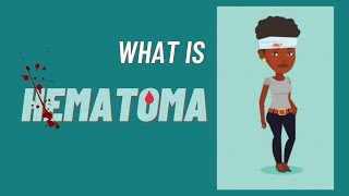 What is a hematoma Hematoma impaired wound healing [upl. by Adnole402]