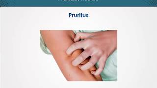 Pruritus  Dermatology  EduRx [upl. by Hammel]