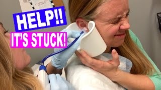 HELP SOMETHINGS STUCK IN MY EAR NASTY EAR WAX REMOVAL [upl. by Pachston]