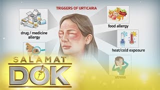 Salamat Dok Causes and symptoms of urticaria [upl. by Aihtyc]