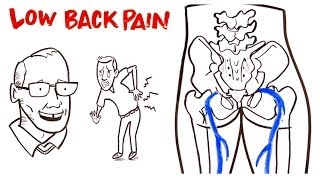 Low Back Pain [upl. by Ellene668]