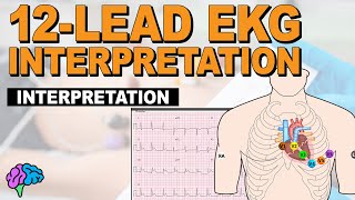 The SIMPLE Steps of 12Lead EKG Interpretation  EXPLAINED CLEARLY [upl. by Annayad]