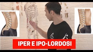 Migliorare la POSTURA DELLA SCHIENA esercizi per IPO e IPER LORDOSI lombare [upl. by Felicity945]