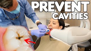 5 Simple Ways To Prevent Cavities [upl. by Ainafetse]