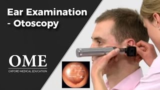 Otoscopy Ear Examination  ENT [upl. by Peggi]