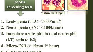 Sepsis and Septic Shock [upl. by Bywaters871]