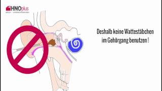 Ohrenschmalz  5 häufige Fragen aus der HNO Praxis [upl. by Marcus250]