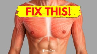 How to Fix Chest Muscle Tightness in 30 SECONDS [upl. by Naujled353]