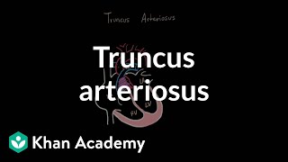 Truncus arteriosu  Circulatory System and Disease  NCLEXRN  Khan Academy [upl. by Amoreta88]