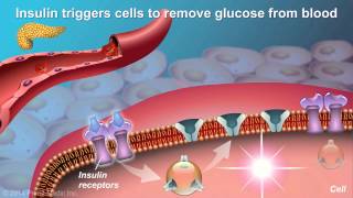 Understanding Type 2 Diabetes [upl. by Cooe]