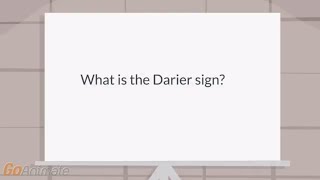 What is the Darier sign [upl. by Sosthena355]