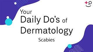 Scabies  Daily Dos of Dermatology [upl. by Ecinhoj]