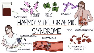 Haemolytic Uraemic Syndrome [upl. by Karrie521]