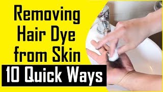 How to Remove Hair Dye from Skin  10 Best Ways to Remove Hair Dye  How to get Hair Dye off Skin [upl. by Acinnor]