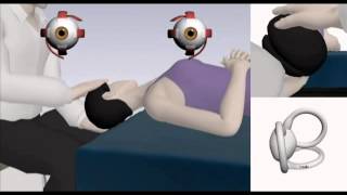 How to perform the epley maneuver at home for BPPV [upl. by Ynnal104]