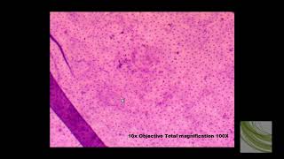 SLIDE Simple Squamous Epithelia [upl. by Perry]