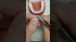 Upper fixed retainer technique [upl. by Demakis]