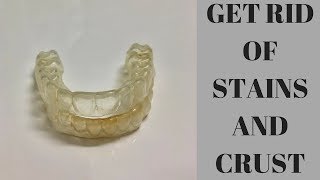 How To Clean Your Retainers [upl. by Ericksen231]