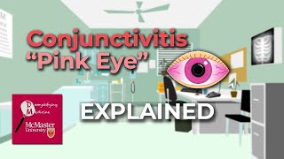 Conjunctivitis Pink Eye Explained [upl. by Walburga]