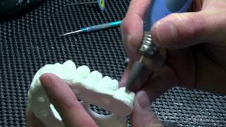 Green State Techniques with Initial Zirconia Disk  Part 01 [upl. by Imuyam]