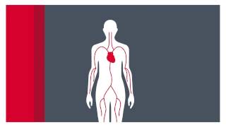 What is atrial fibrillation [upl. by Kelila763]