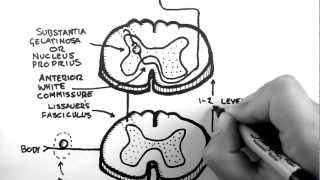 What to expect during a Myelogram at CDI [upl. by Calder841]