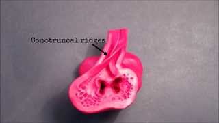 Heart Embryology Animation [upl. by Roumell45]