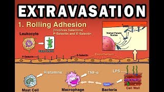 EXTRAVASATION [upl. by Yruama]