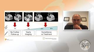 Small Renal Masses An Overview [upl. by Churchill680]