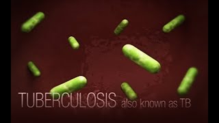 CDC Tuberculosis TB Transmission and Pathogenesis Video [upl. by Amehsat334]