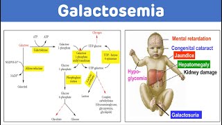 Glucose HA1C and OGTT  clinical chem lab tests review [upl. by Oinota]