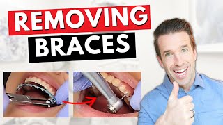 Removing Braces  How We Take Off Braces  Dr Nate [upl. by Duwe]