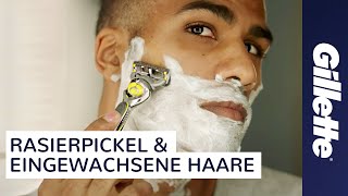 Eingewachsene Haare amp Rasierpickel Tutorial  Gillette ProShield [upl. by Schreib]