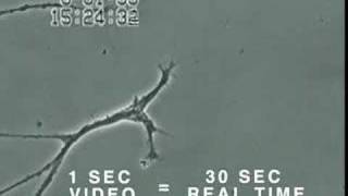 How Mercury Causes Brain Neuron Damage  Uni of Calgary [upl. by Idissak829]